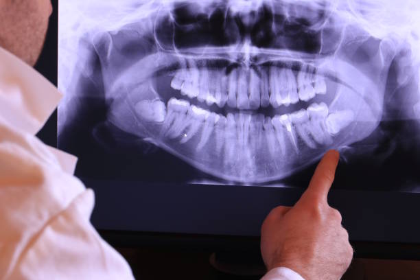 Best Emergency Dental Extractions in Union Hall, VA