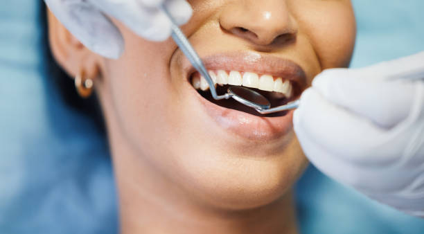 Best Emergency Root Canal Treatment in Union Hall, VA