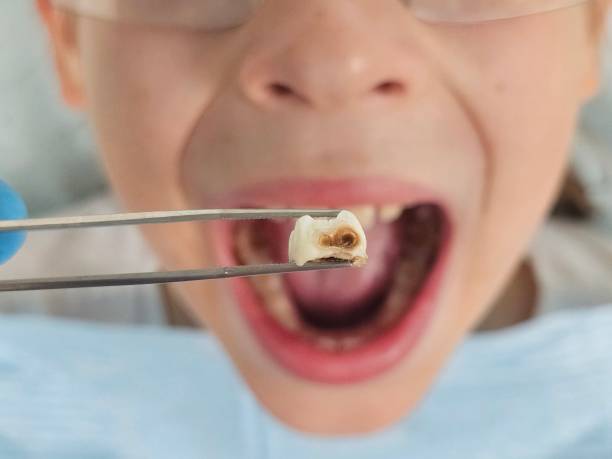 Best Emergency Cosmetic Dentistry in Union Hall, VA